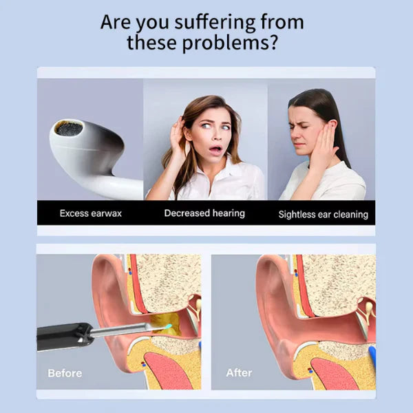HD Wireless Ear Wax Removal Camera