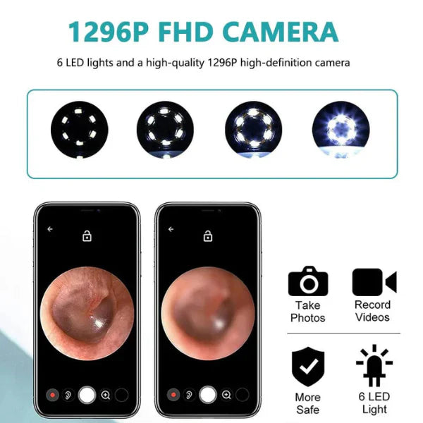 HD Wireless Ear Wax Removal Camera