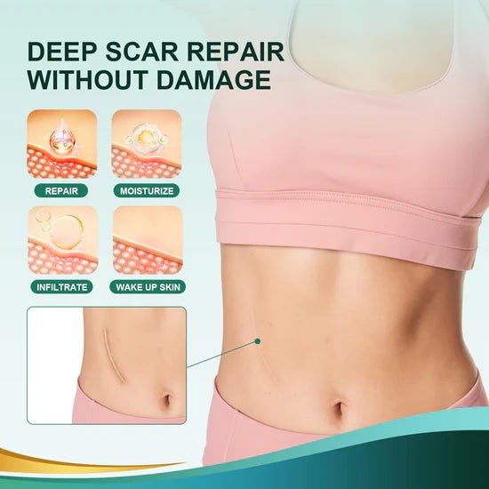 Soft Silicone Scar Tape for Scars Removal, Reusable Easy-Tear Silicone Tape Painless Scar Removal for Surgery, C-section