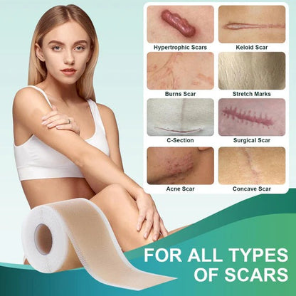 Soft Silicone Scar Tape for Scars Removal, Reusable Easy-Tear Silicone Tape Painless Scar Removal for Surgery, C-section
