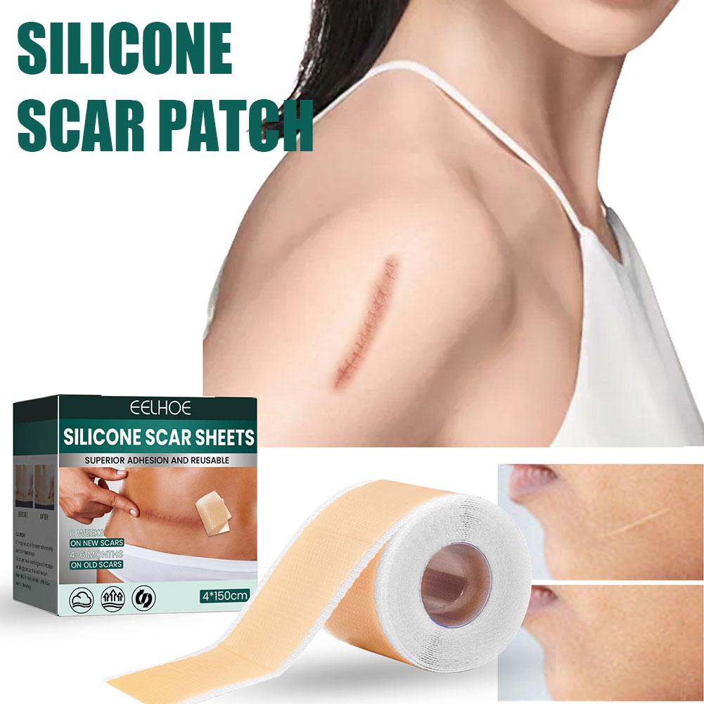 Soft Silicone Scar Tape for Scars Removal, Reusable Easy-Tear Silicone Tape Painless Scar Removal for Surgery, C-section